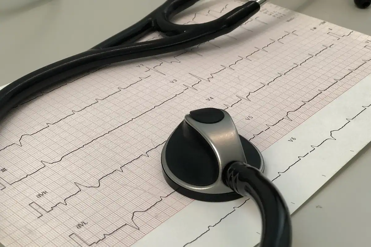Rezultate medicale pe hârtie și un stetoscop pe birou, pentru interpretarea unui raport
